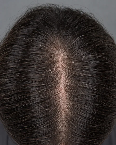 Illustrative image — A dry, sensitive-feeling scalp, view 2
