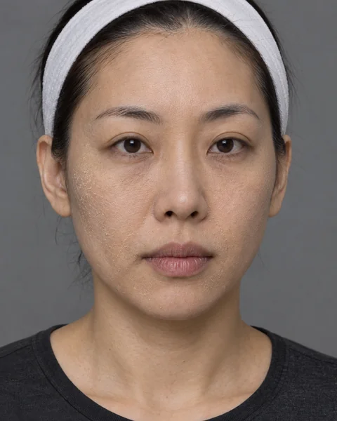 Illustrative image — Dehydrated skin that has lost its sheen, view 2