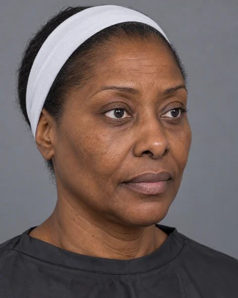 Illustrative image — Skin losing its firmness and smoothness, view 2