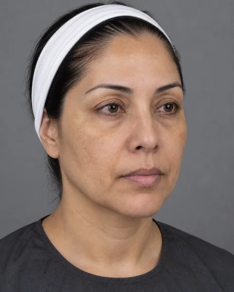 Illustrative image — Skin that looks dull and uneven in tone, view 2